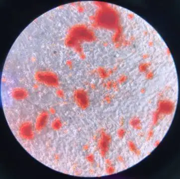 Adipose-derived stem cells
